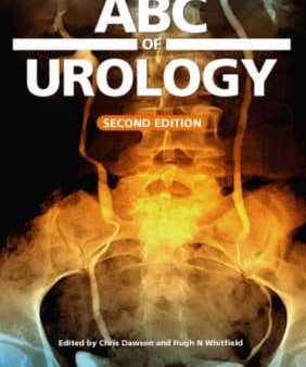 ABC of Urology Cheap